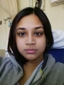 Swollen face - hypothyroid TSH 40